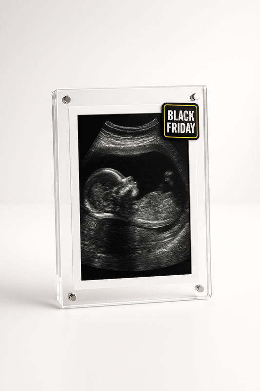 AuraFrame™ – Digital Photo Frame